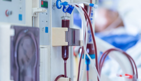 Dialysis Center in Bangalore