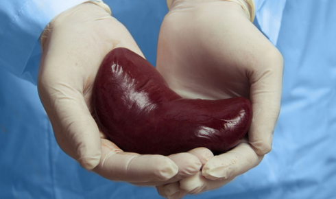 Best kidney transplant hospital in bangalore
