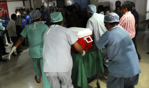 Best kidney transplant in bangalore