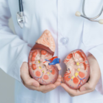Best kidney transplant hospital in bangalore